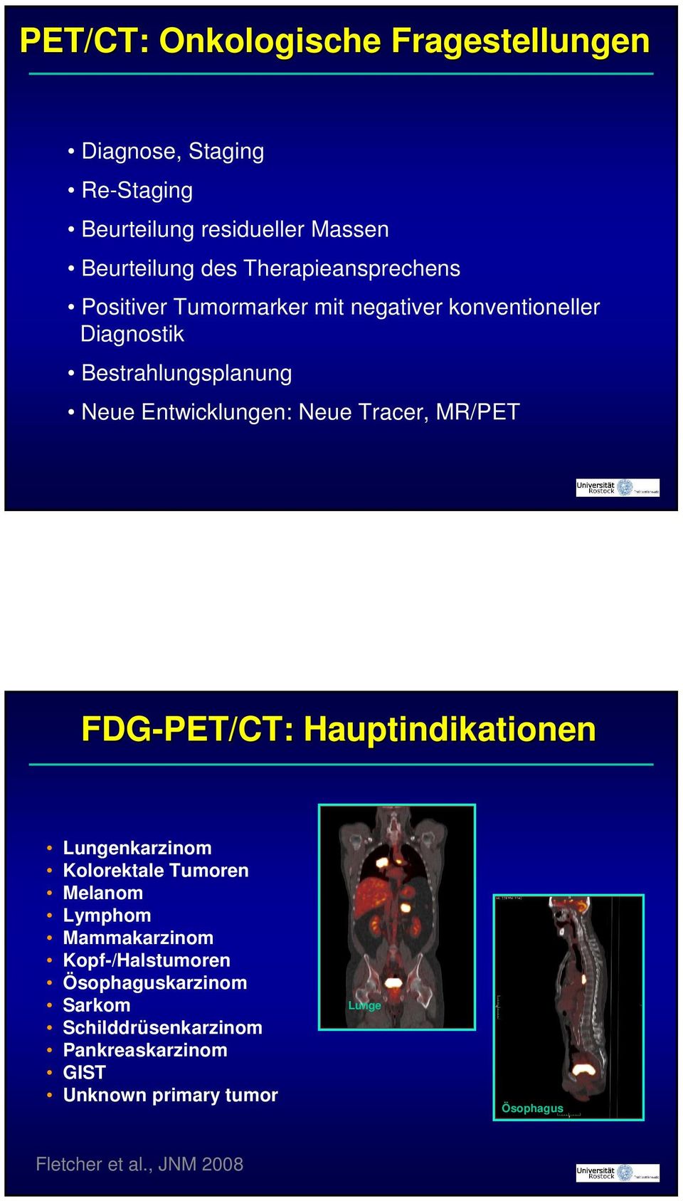 Neue Tracer, MR/PET FDG-PET/CT: Hauptindikationen Lungenkarzinom Kolorektale Tumoren Melanom Lymphom Mammakarzinom