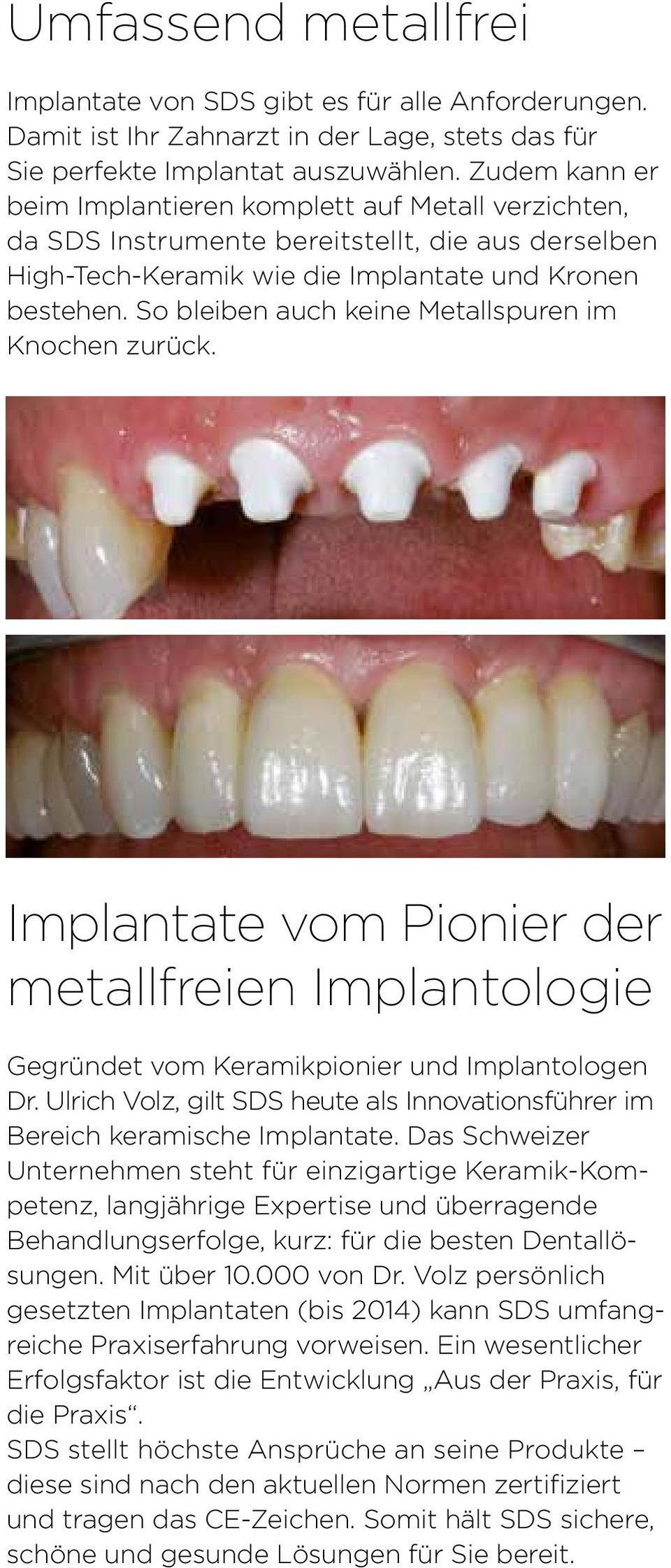 So bleiben auch keine Metallspuren im Knochen zurück. Implantate vom Pionier der metallfreien Implantologie Gegründet vom Keramikpionier und Implantologen Dr.