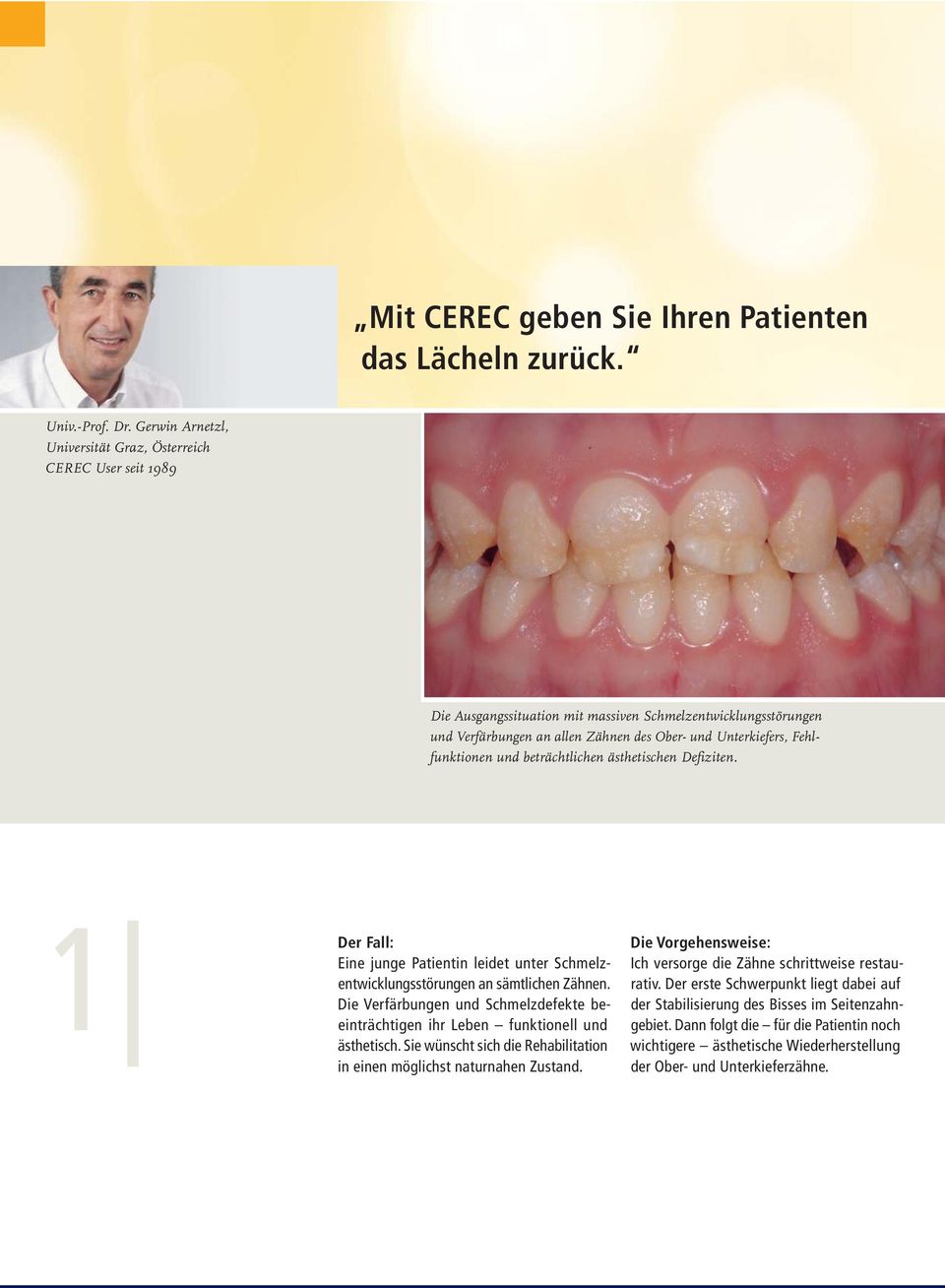 Fehlfunktionen und beträchtlichen ästhetischen Defiziten. 1 Der Fall: Eine junge Patientin leidet unter Schmelzentwicklungsstörungen an sämtlichen Zähnen.