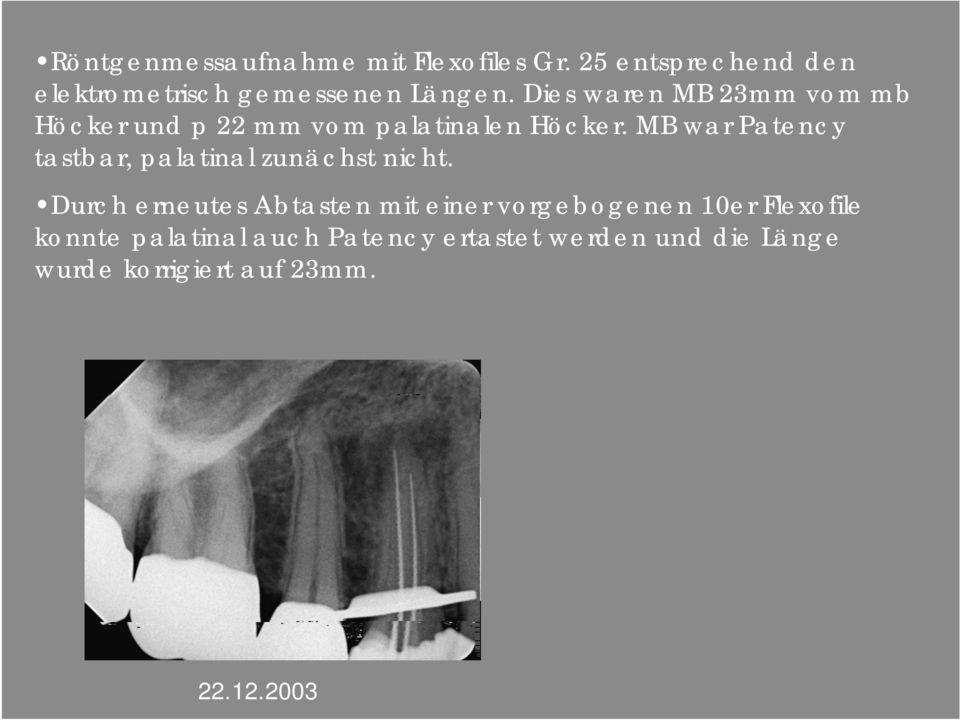 MB war Patency tastbar, palatinal zunächst nicht.