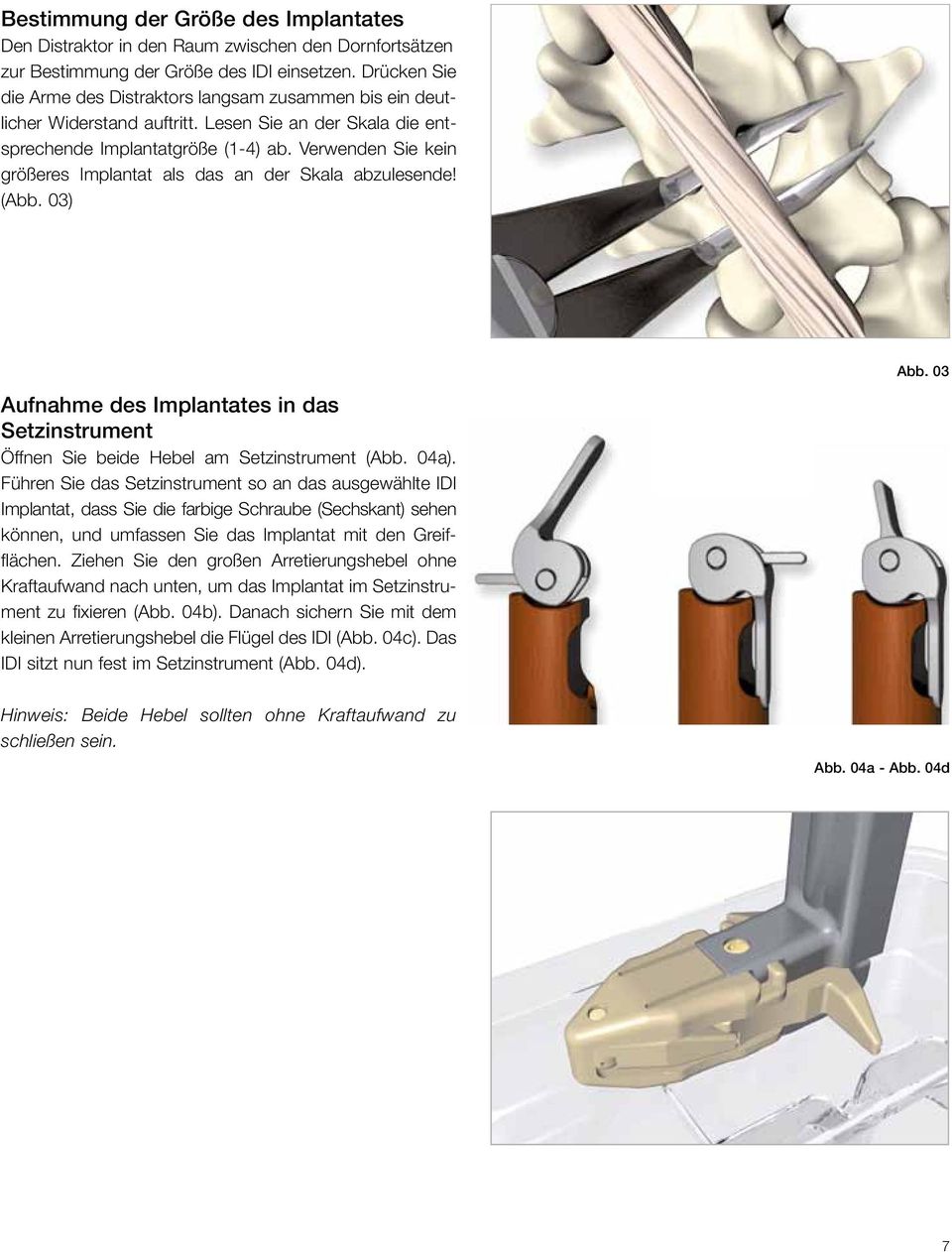 Verwenden Sie kein größeres Implantat als das an der Skala abzulesende! (Abb. 03) Aufnahme des Implantates in das Setzinstrument Öffnen Sie beide Hebel am Setzinstrument (Abb. 04a).