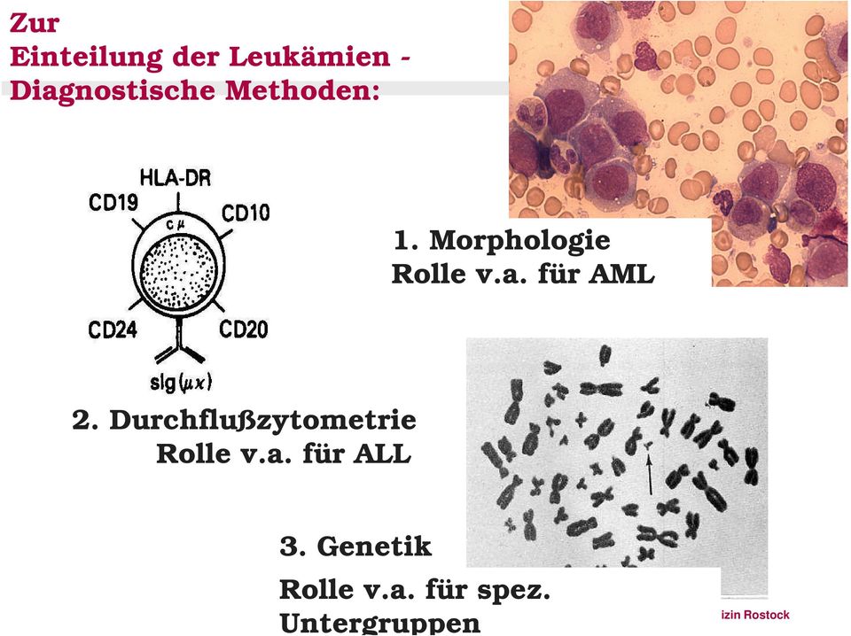 Morphologie Rolle v.a. für AML 2.