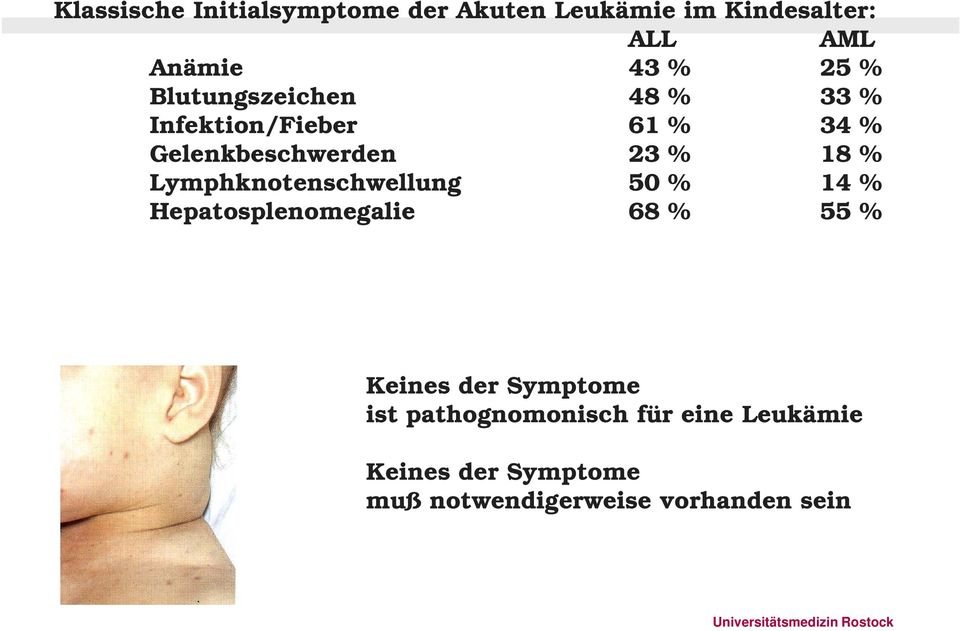 Lymphknotenschwellung 50 % 14 % Hepatosplenomegalie 68 % 55 % Keines der Symptome ist