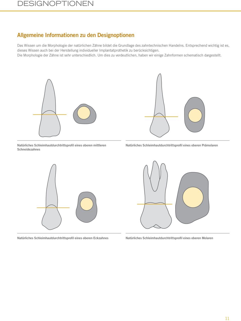 Um dies zu verdeutlichen, haben wir einige Zahnformen schematisch dargestellt.