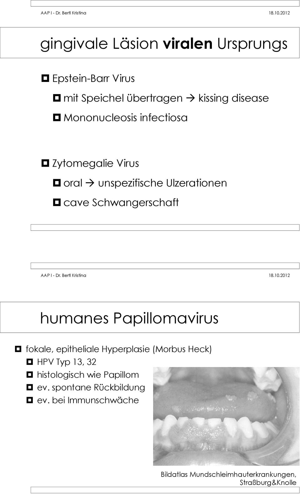 cave Schwangerschaft humanes Papillomavirus! fokale, epitheliale Hyperplasie (Morbus Heck)!