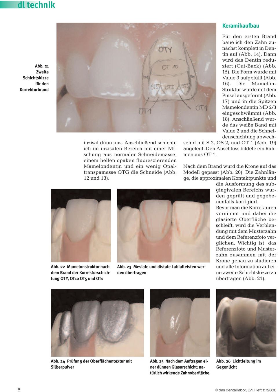 12 und 13). Abb. 23 Mesiale und distale Labialleisten werden übertragen Keramikaufbau Für den ersten Brand baue ich den Zahn zunächst komplett in Dentin auf (Abb. 14).