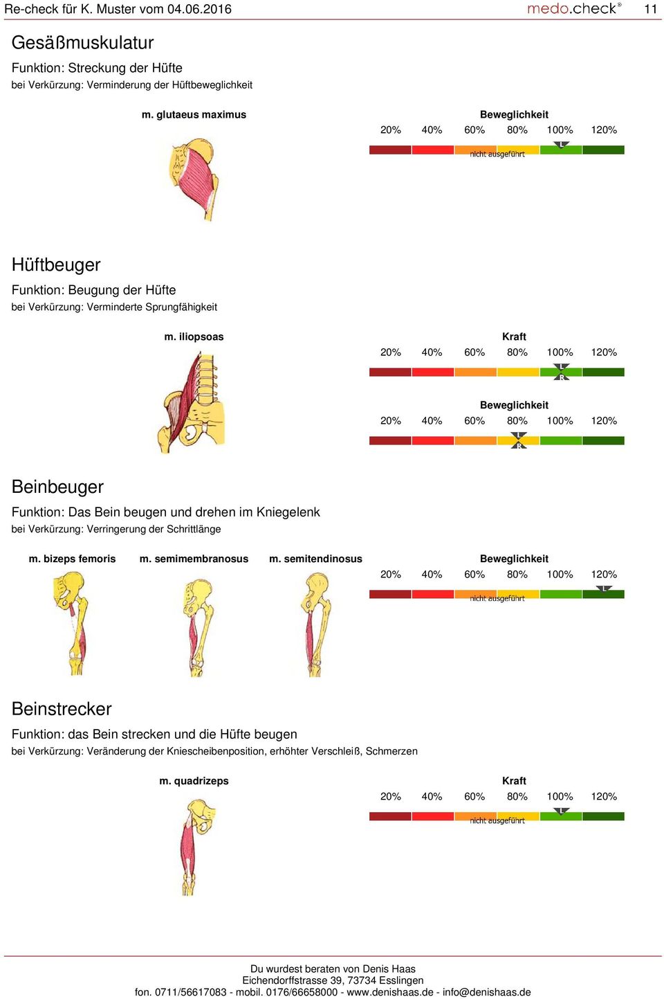 iliopsoas Kraft Beweglichkeit Beinbeuger Funktion: Das Bein beugen und drehen im Kniegelenk bei Verkürzung: Verringerung der Schrittlänge m. bizeps femoris m.