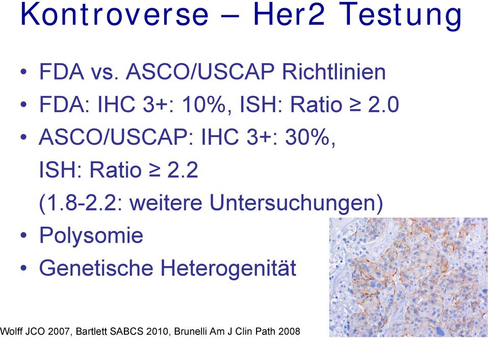 0 ASCO/USCAP: IHC 3+: 30%, ISH: Ratio 2.2 (1.8-2.