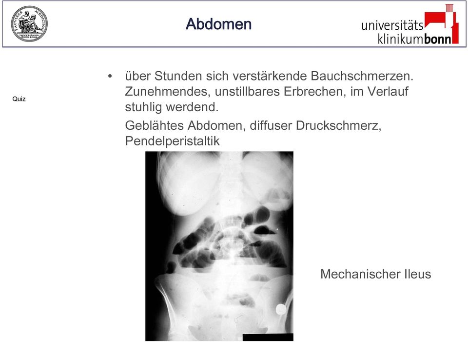 Zunehmendes, unstillbares Erbrechen, im Verlauf