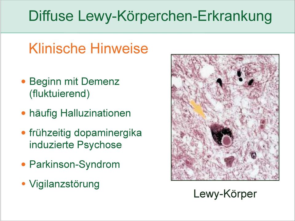 Halluzinationen frühzeitig dopaminergika