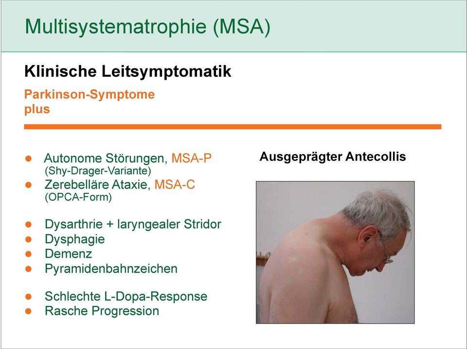 (OPCA-Form) Ausgeprägter Antecollis Dysarthrie + laryngealer Stridor