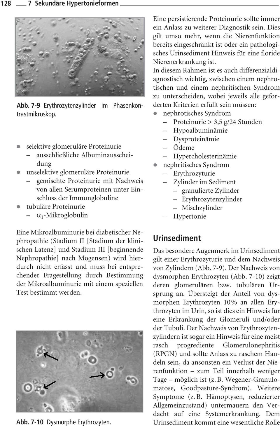 Immunglobuline tubuläre Proteinurie α 1 -Mikroglobulin Eine Mikroalbuminurie bei diabetischer Nephropathie (Stadium II [Stadium der klinischen Latenz] und Stadium III [beginnende Nephropathie] nach