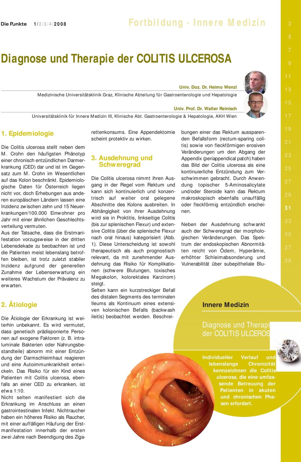 Gastroenterologie & Hepatologie, AKH Wien 13 15 17 1. Epidemiologie Die Colitis ulcerosa stellt neben dem M.