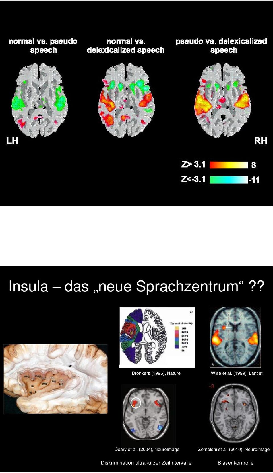 (2004), NeuroImage Diskrimination ultrakurzer