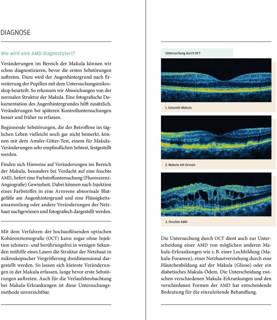 Eine fotografische Dokumentation des Augenhintergrundes hilft zusätzlich, Veränderungen bei spä teren Kontrolluntersuchungen besser und früher zu erfassen. Untersuchung durch OCT 1.