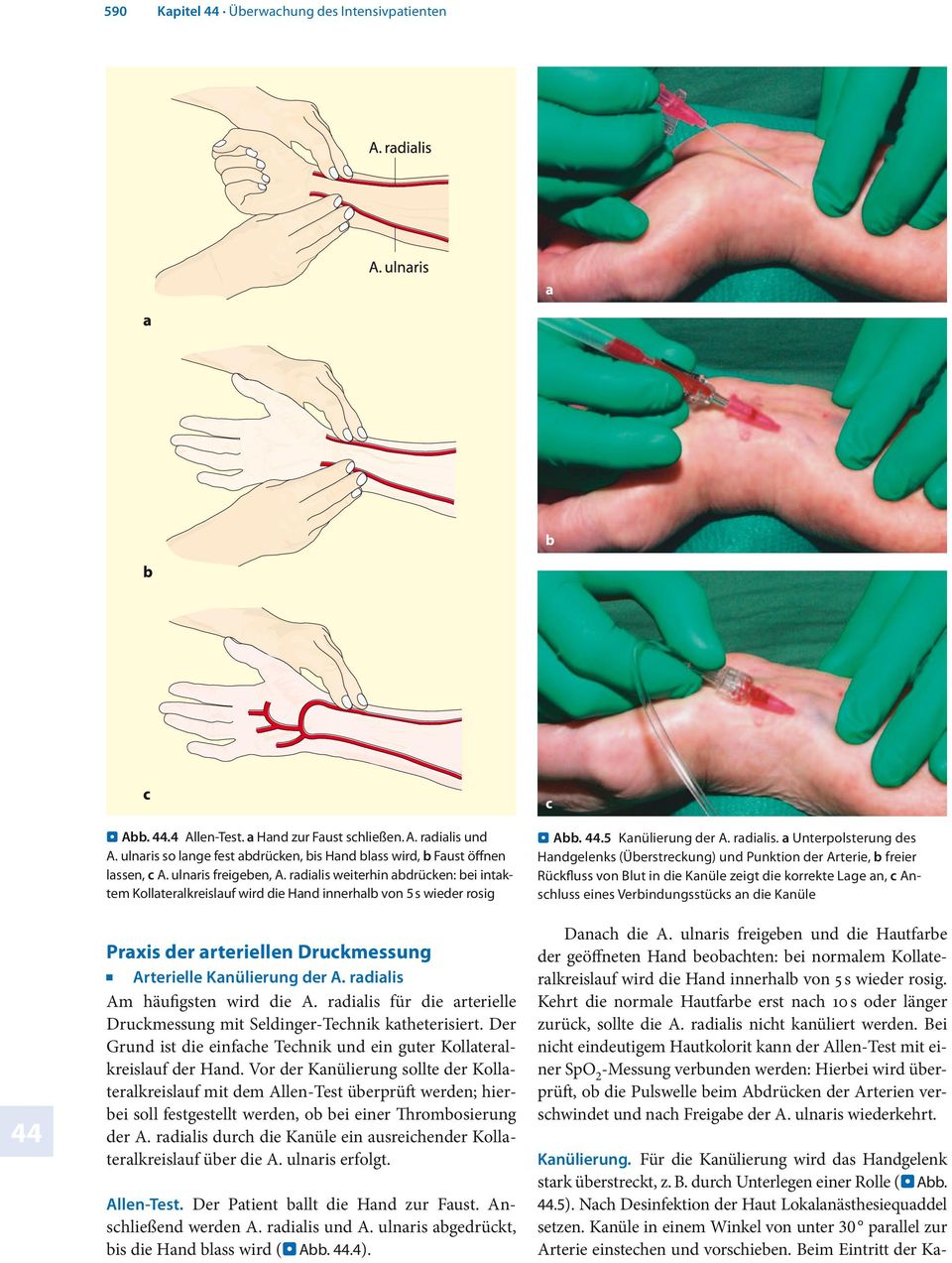 radialis Am häufigsten wird die A. radialis für die arterielle Druckmessung mit Seldinger-Technik katheterisiert. Der Grund ist die einfache Technik und ein guter Kollateralkreislauf der Hand.