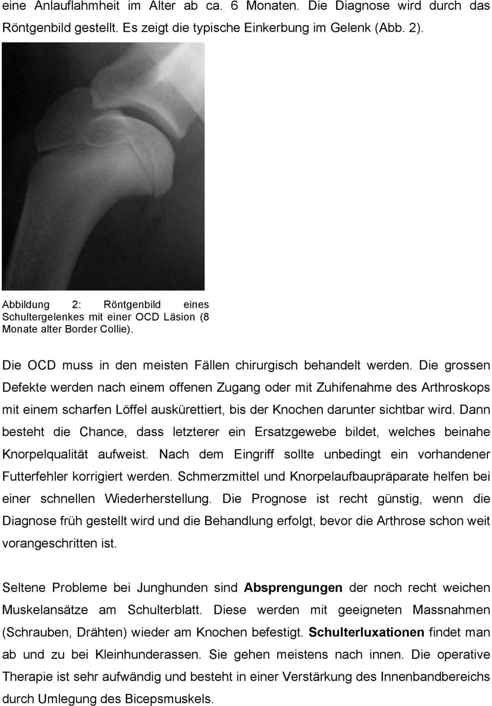 Die grossen Defekte werden nach einem offenen Zugang oder mit Zuhifenahme des Arthroskops mit einem scharfen Löffel auskürettiert, bis der Knochen darunter sichtbar wird.