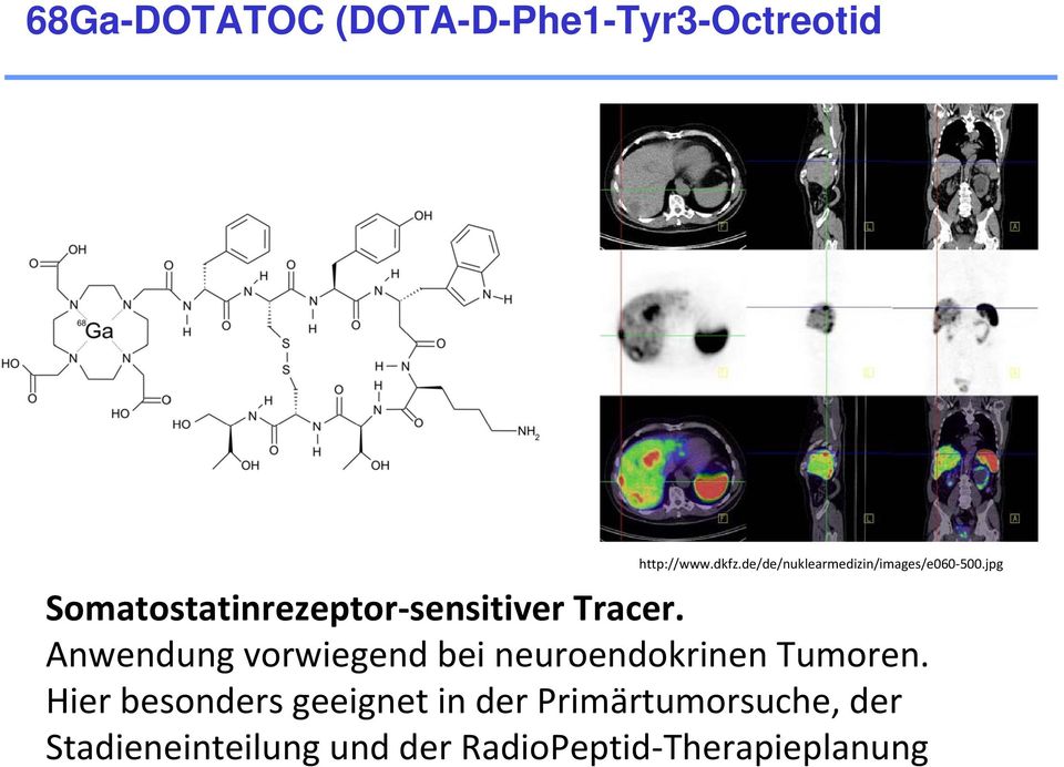 jpg Somatostatinrezeptor sensitiver Tracer.