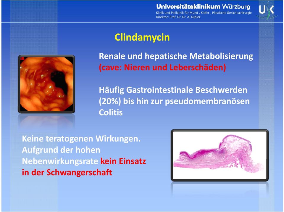Schwangerschaft Renaleund hepatische h Metabolisierung i (cave: