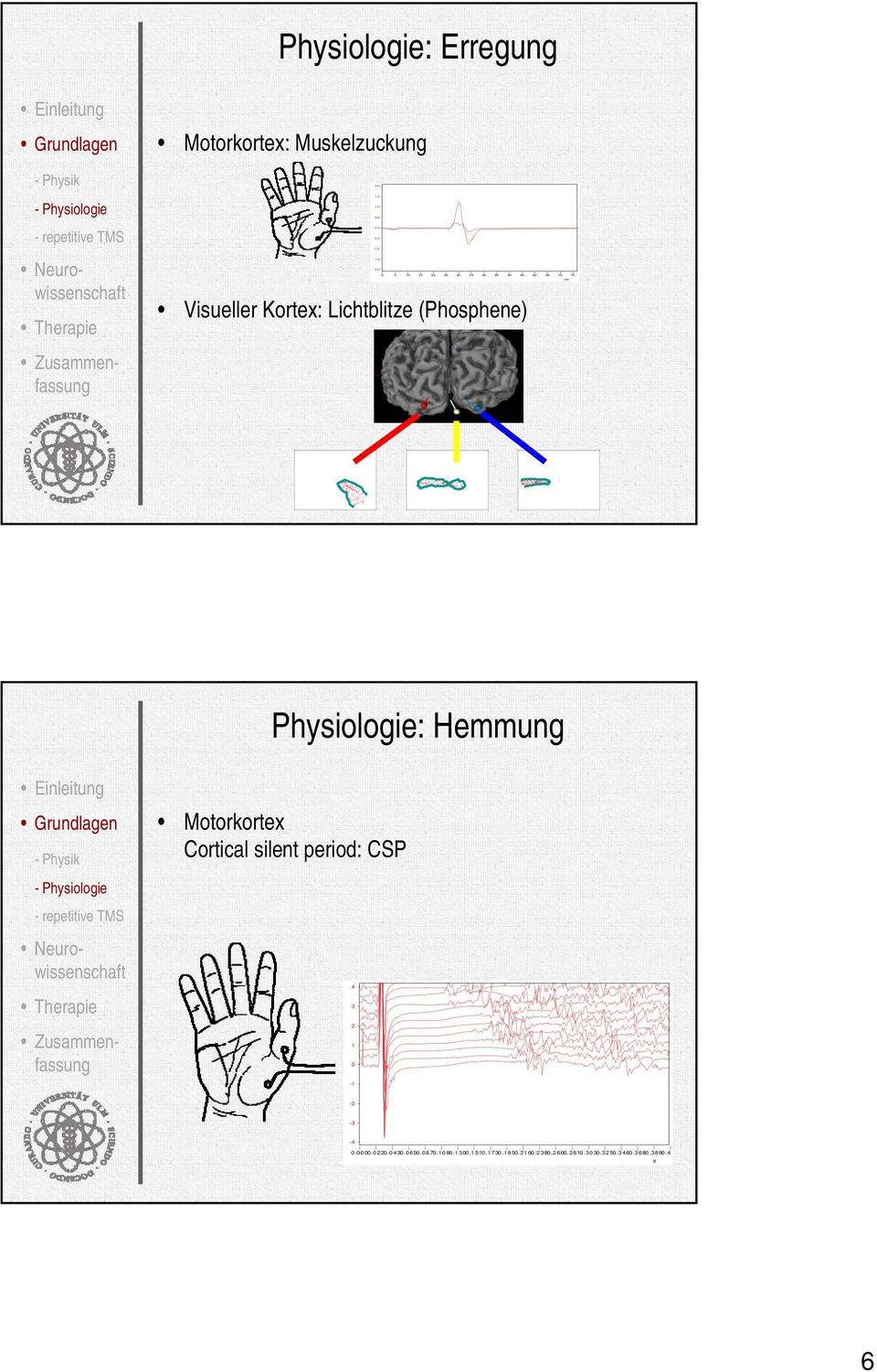 Physiologie: Hemmung - Physik Motorkortex Cortical silent period: CSP - Physiologie - repetitive TMS 4 3 2 1
