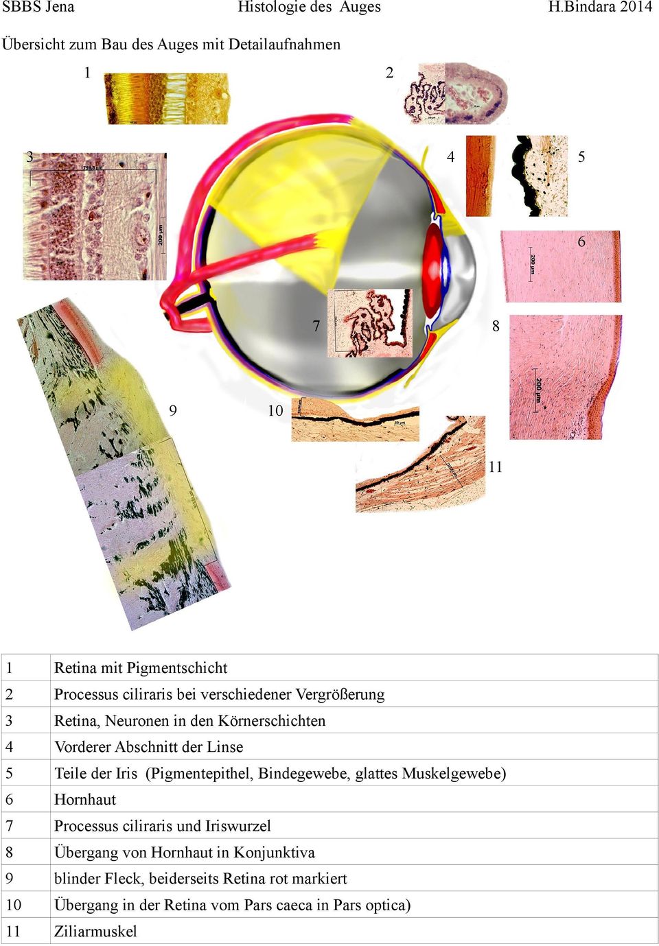 (Pigmentepithel, Bindegewebe, glattes Muskelgewebe) 6 Hornhaut 7 Processus ciliraris und Iriswurzel 8 Übergang von Hornhaut