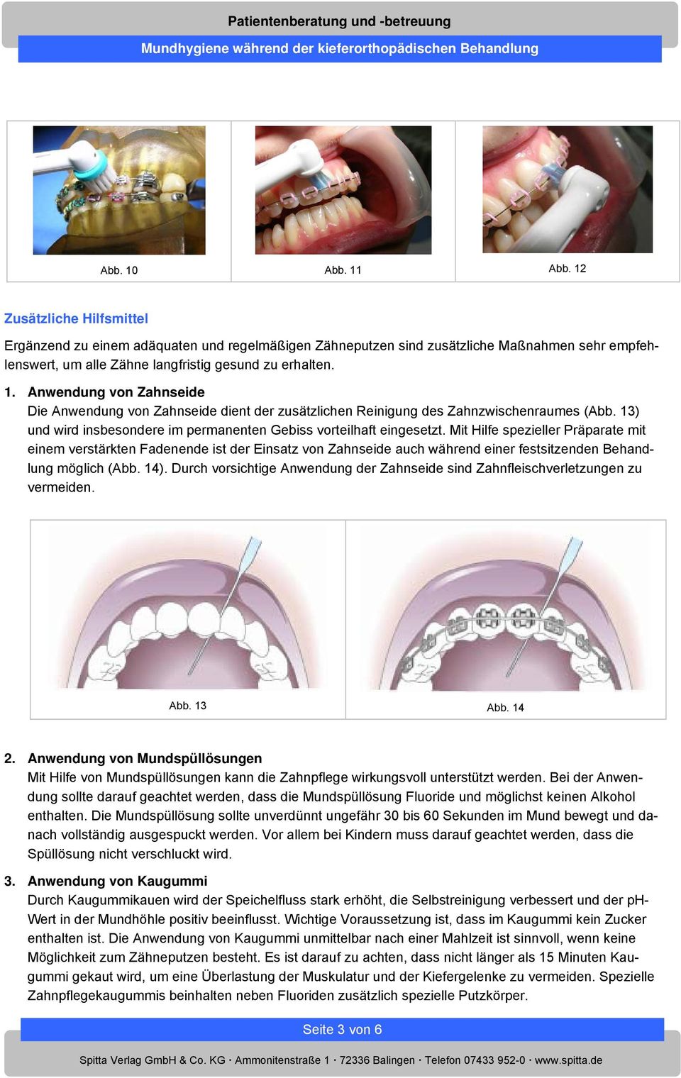 Mit Hilfe spezieller Präparate mit einem verstärkten Fadenende ist der Einsatz von Zahnseide auch während einer festsitzenden Behandlung möglich (Abb. 14).