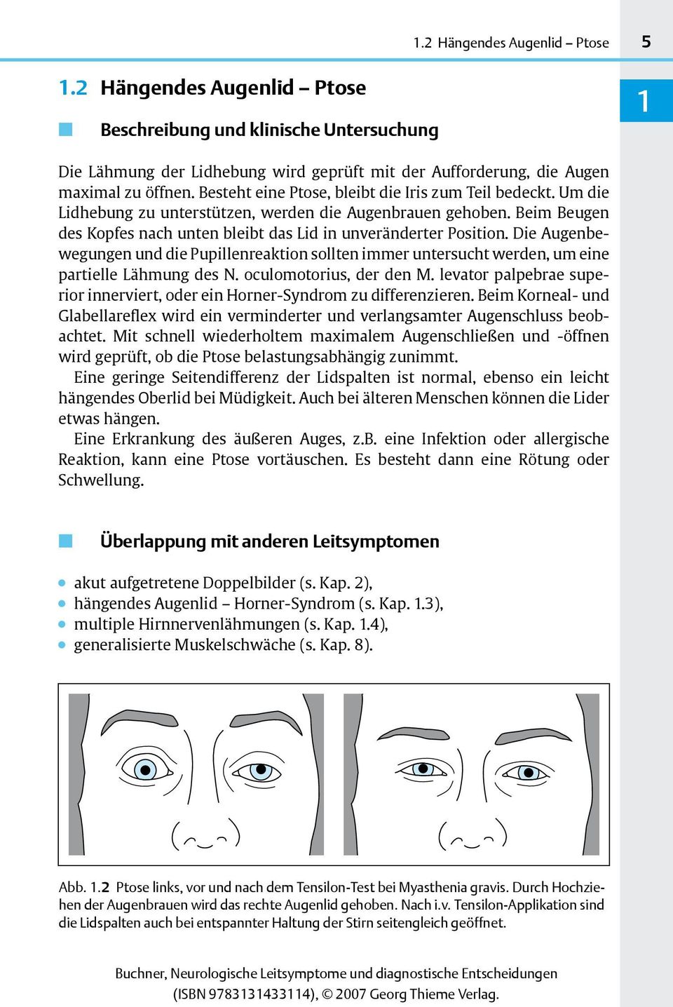 Die Augenbewegungen und die Pupillenreaktion sollten immer untersucht werden, um eine partielle Lähmung des N. oculomotorius, der den M.