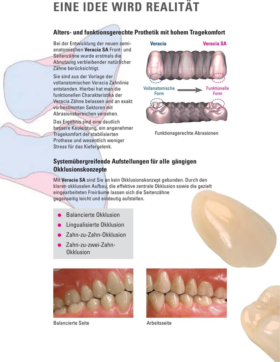 Hierbei hat man die funktionellen Charakteristika der Veracia Zähne belassen und an exakt vorbestimmten Sektoren mit Abrasions bereichen versehen.