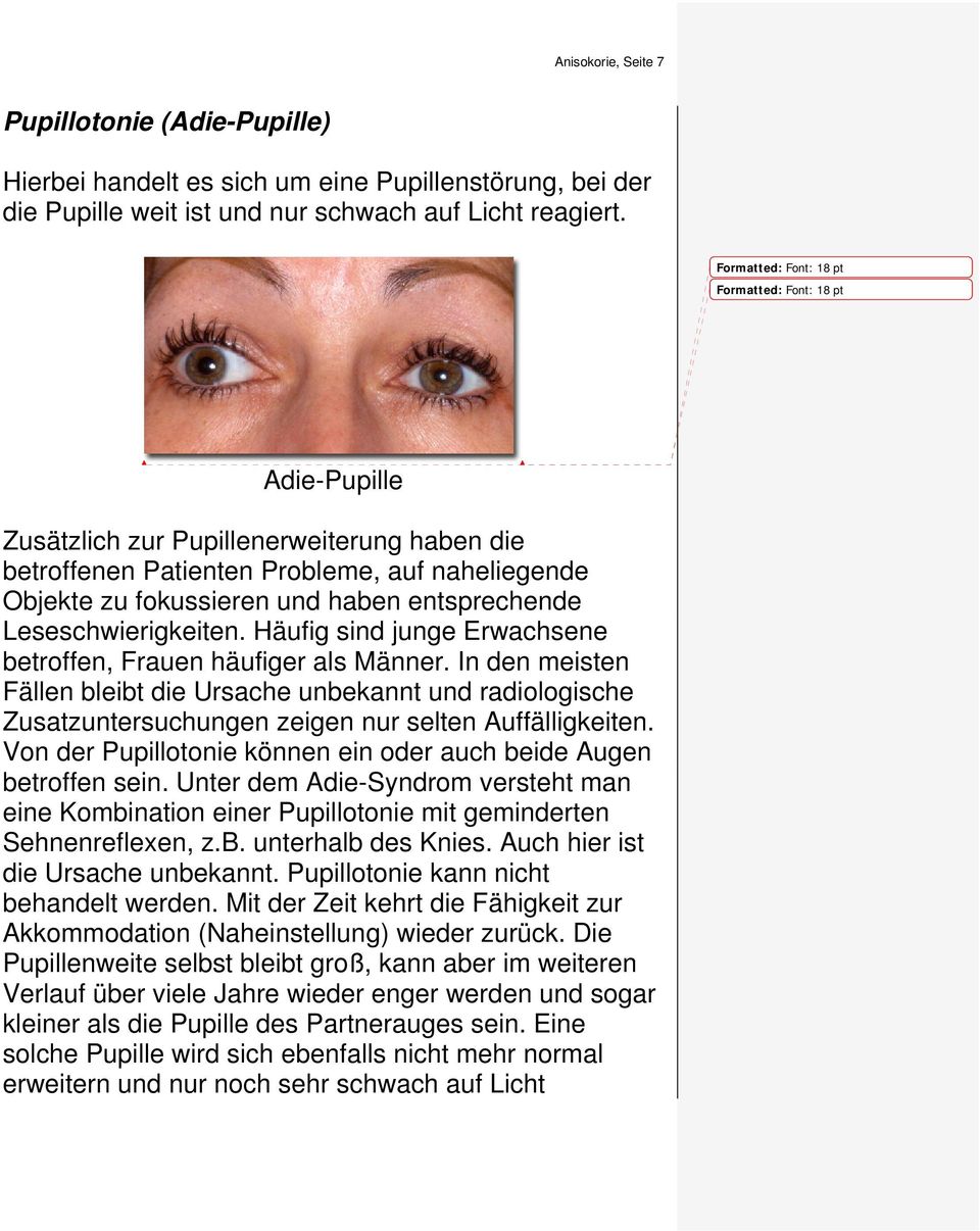 Häufig sind junge Erwachsene betroffen, Frauen häufiger als Männer. In den meisten Fällen bleibt die Ursache unbekannt und radiologische Zusatzuntersuchungen zeigen nur selten Auffälligkeiten.