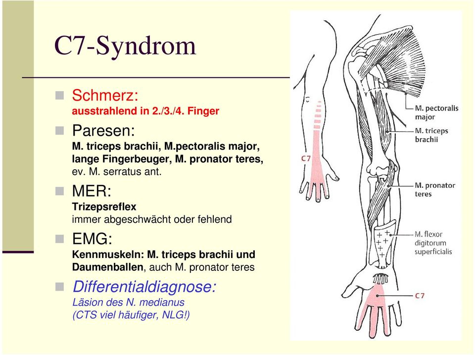 MER: Trizepsreflex immer abgeschwächt oder fehlend EMG: Kennmuskeln: M.