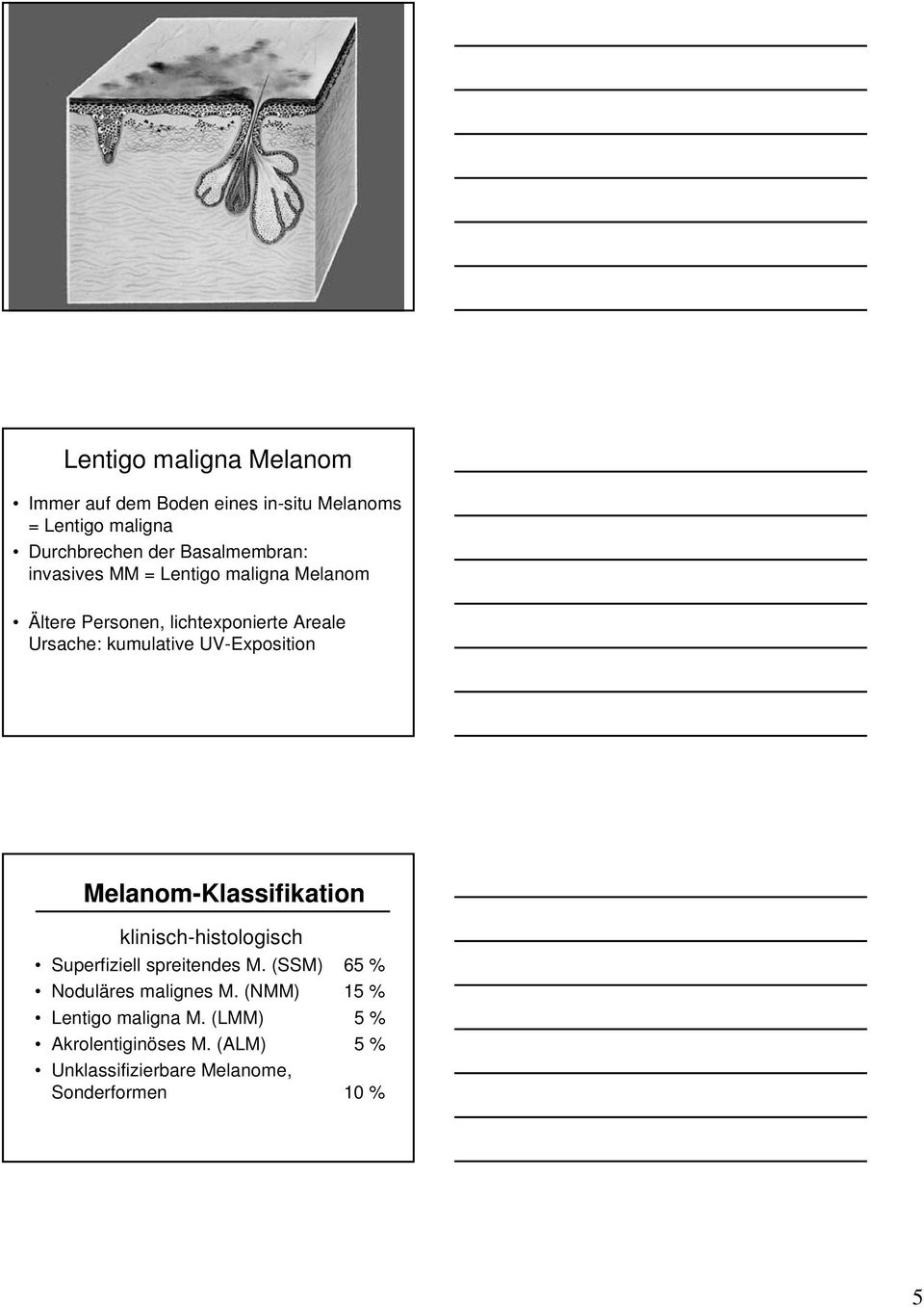 UV-Exposition Melanom-Klassifikation klinisch-histologisch Superfiziell spreitendes M.