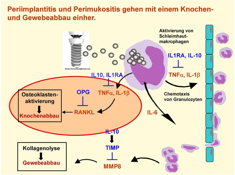 Aktivierung von Schleimhautmakrophagen IL1RA, IL-10 Markus-Kretschmar@fotolia.