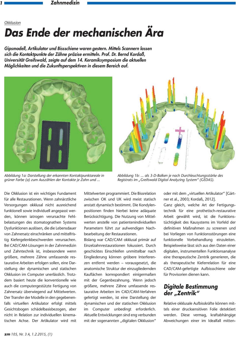 Abbildung 1a: Darstellung der erkannten Kontaktpunktareale in grüner Farbe (a) zum Auszählen der Kontakte je Zahn und... Abbildung 1b:.