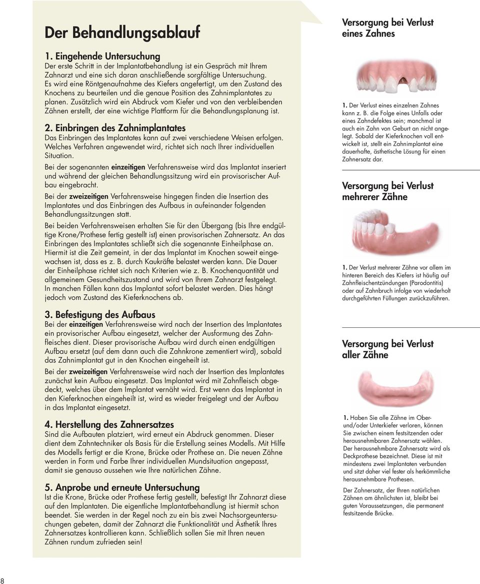 Zusätzlich wird ein Abdruck vom Kiefer und von den verbleibenden Zähnen erstellt, der eine wichtige Plattform für die Behandlungsplanung ist. 2.