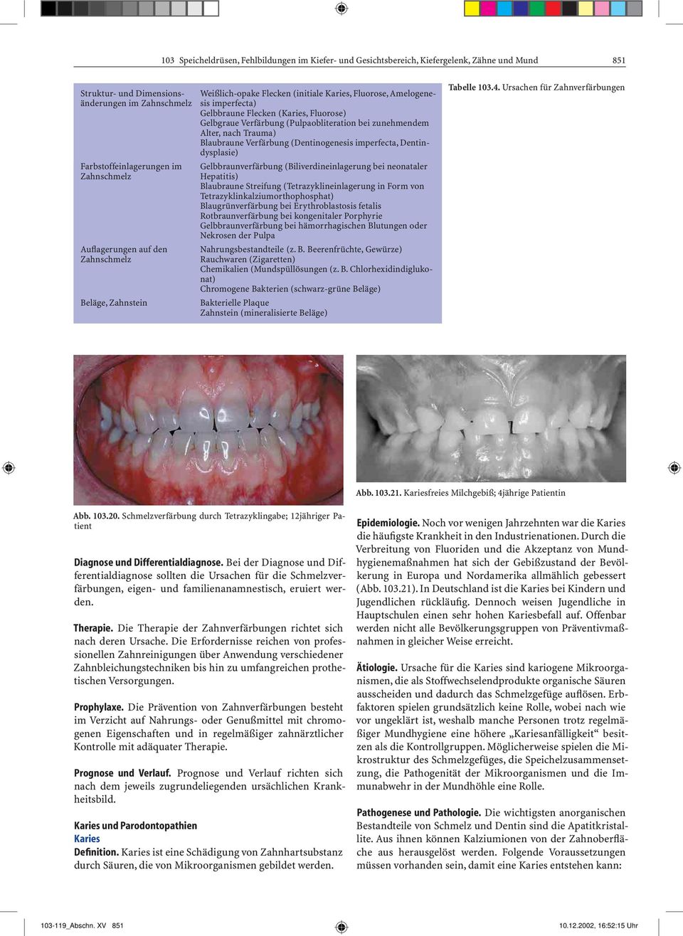 (Pulpaobliteration bei zunehmendem Alter, nach Trauma) Blaubraune Verfärbung (Dentinogenesis imperfecta, Dentindysplasie) Gelbbraunverfärbung (Biliverdineinlagerung bei neonataler Hepatitis)