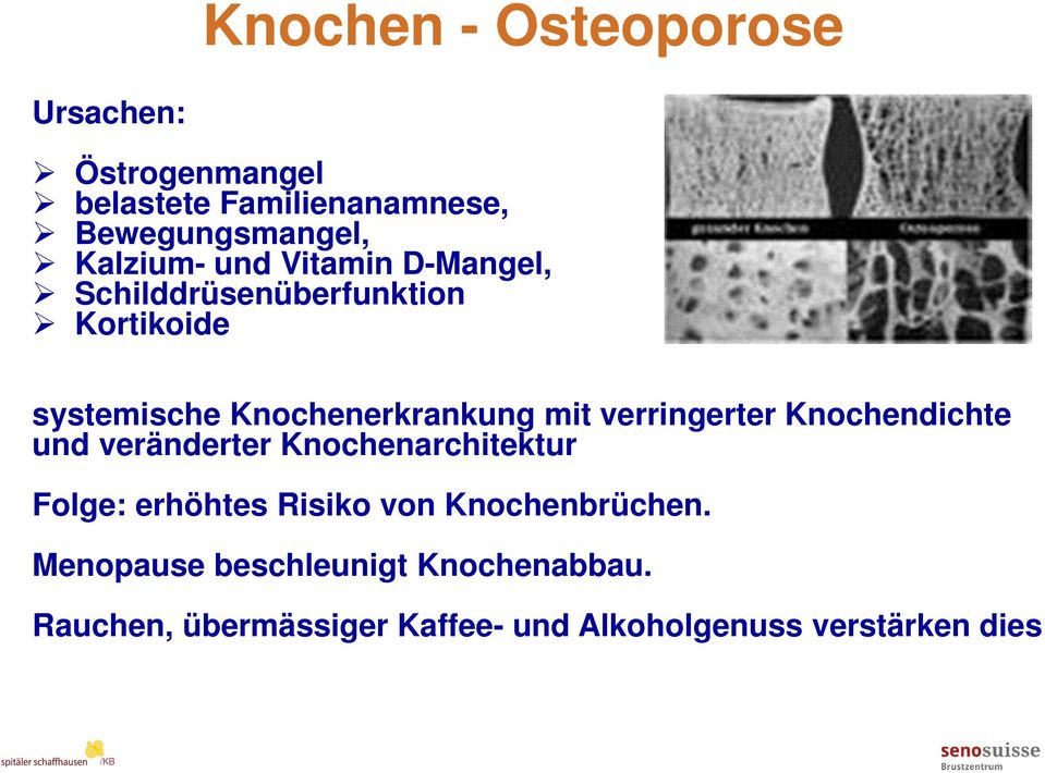 mit verringerter Knochendichte und veränderter Knochenarchitektur Folge: erhöhtes Risiko von