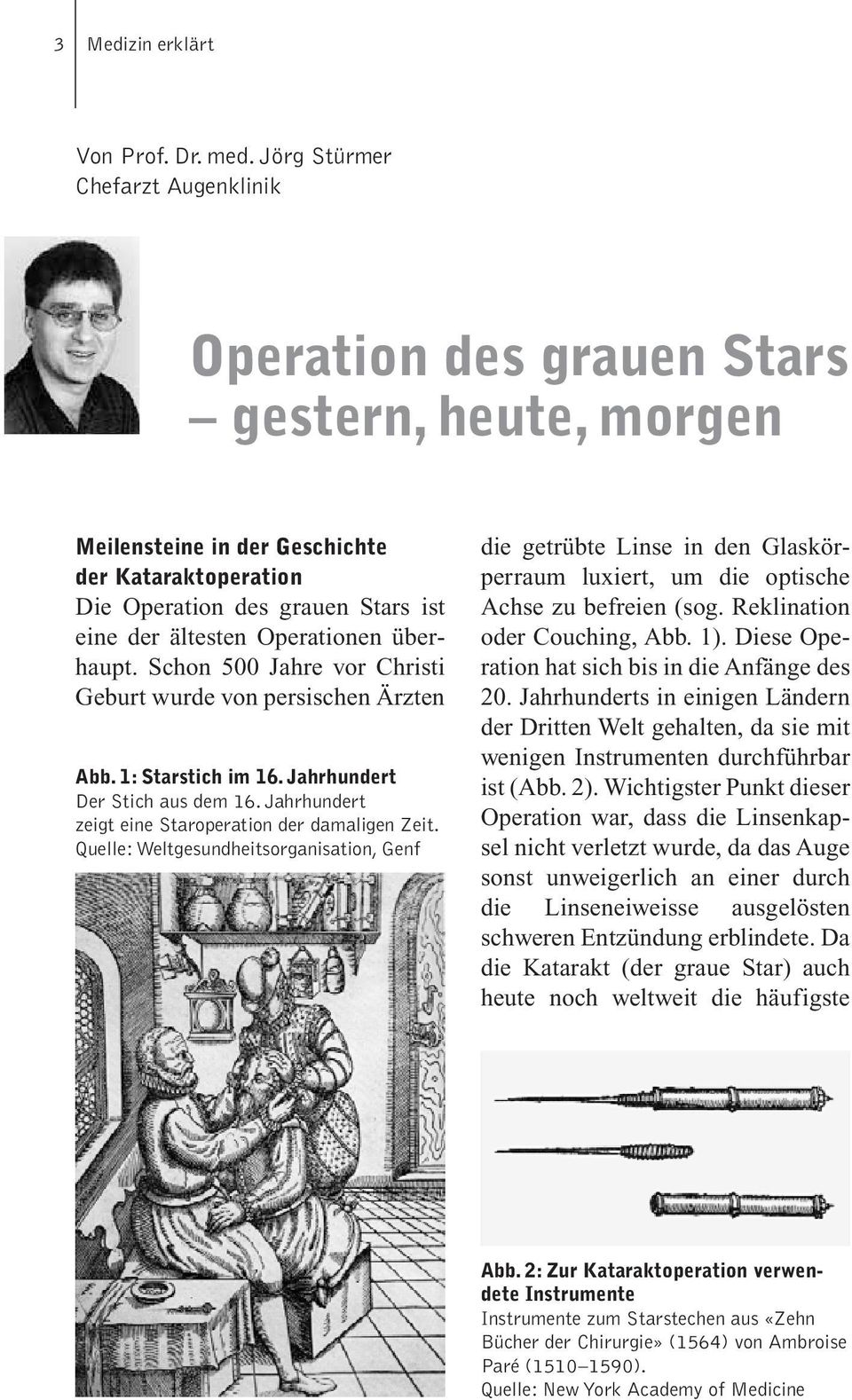 Operationen überhaupt. Schon 500 Jahre vor Christi Geburt wurde von persischen Ärzten Abb. 1: Starstich im 16. Jahrhundert Der Stich aus dem 16.