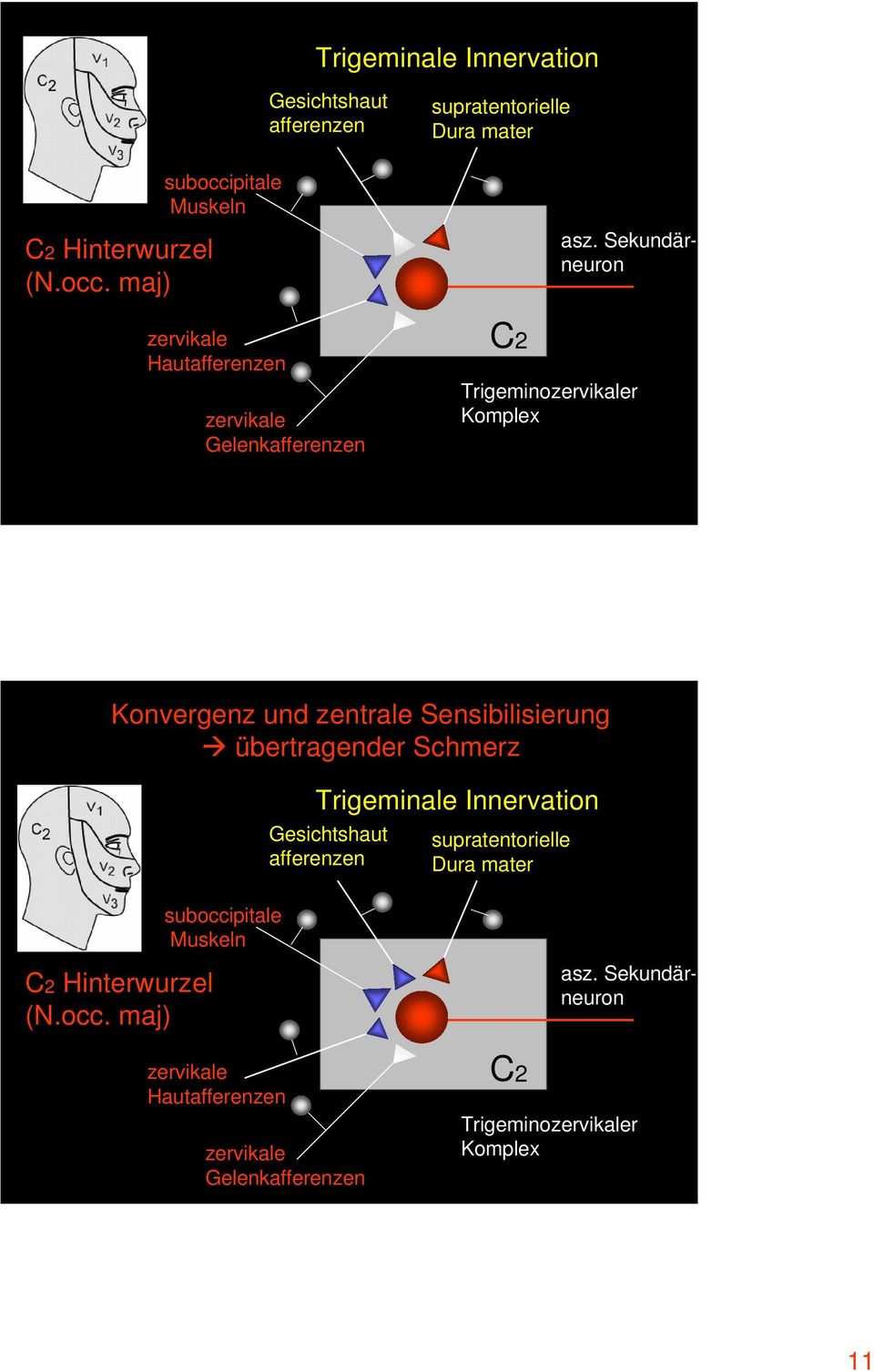 Sekundärneuron Trigeminor Komplex Konvergenz und zentrale Sensibilisierung übertragender Schmerz suboccipitale