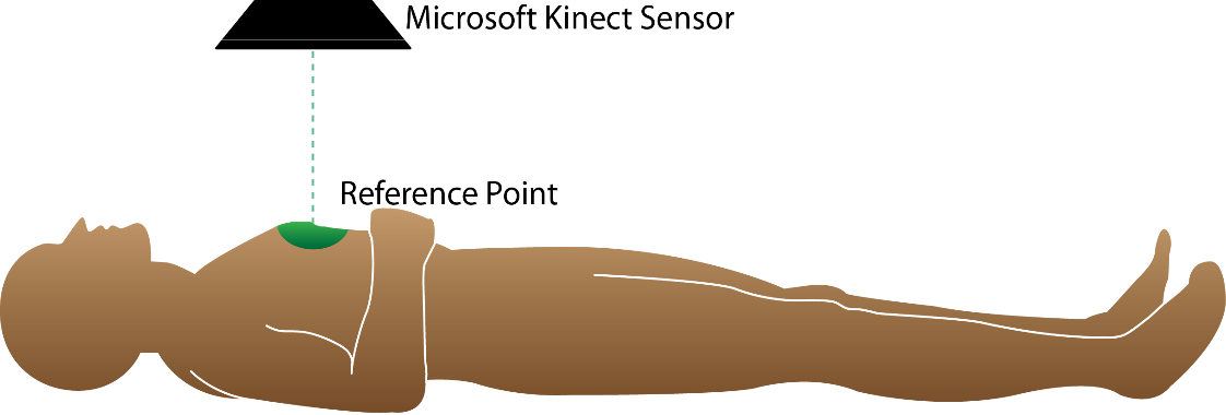 der Microsoft Kinect zur Bestimmung des Referenzpunktes Microsoft Kinect Sensor