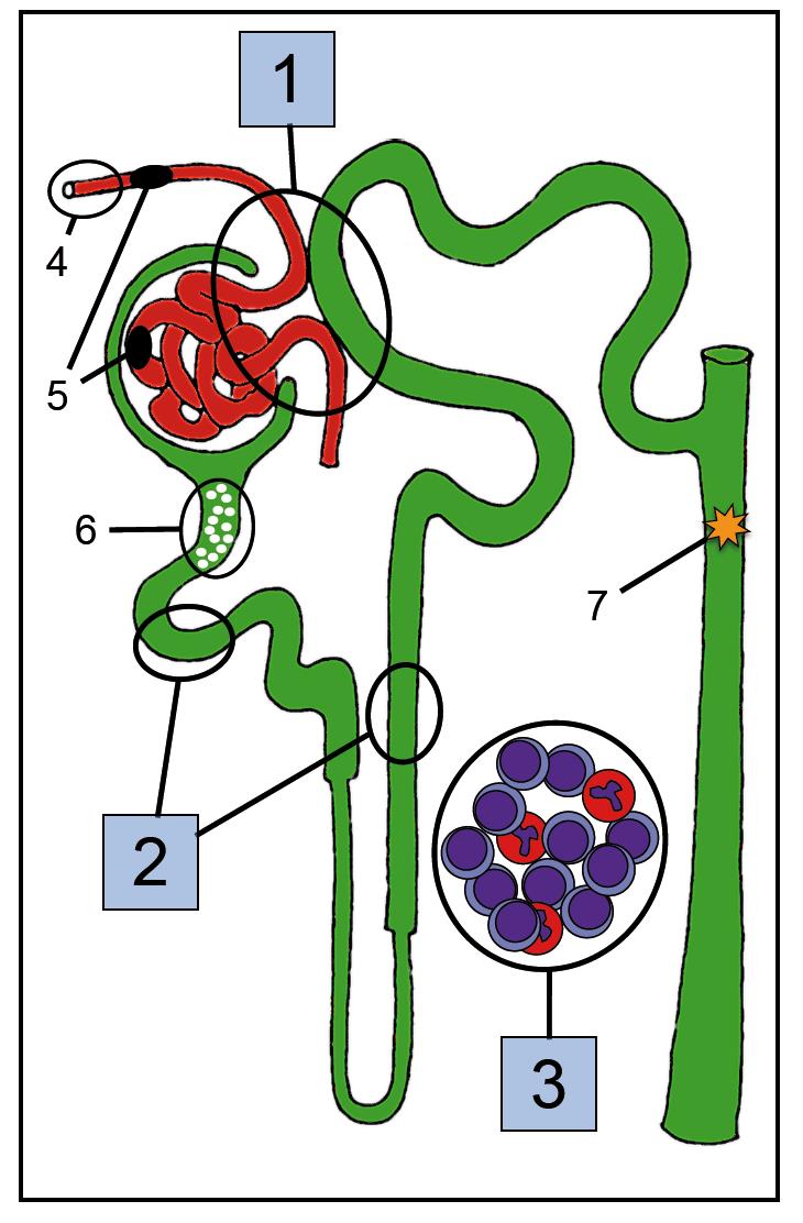 Pathophysiologie medikamentöser Nierenschäden 1. Dysregulation der glomerulären Hämodynamik 2. Nephrotoxizität im engeren Sinne (Tubuluszellschaden) 3.
