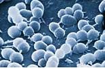 12 Enterokokken Eigenschaften - kokkoide Bakterien (Kugelbakterien) - Hinweis auf fäkale Verunreinigung - überleben länger im Wasser als E.