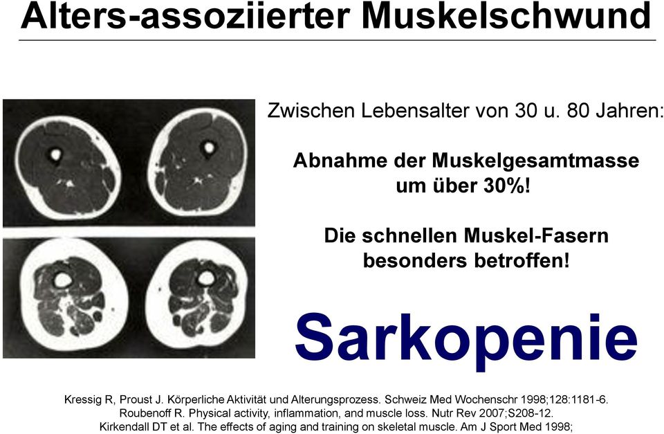 Sarkopenie Kressig R, Proust J. Körperliche Aktivität und Alterungsprozess. Schweiz Med Wochenschr 1998;128:1181-6.
