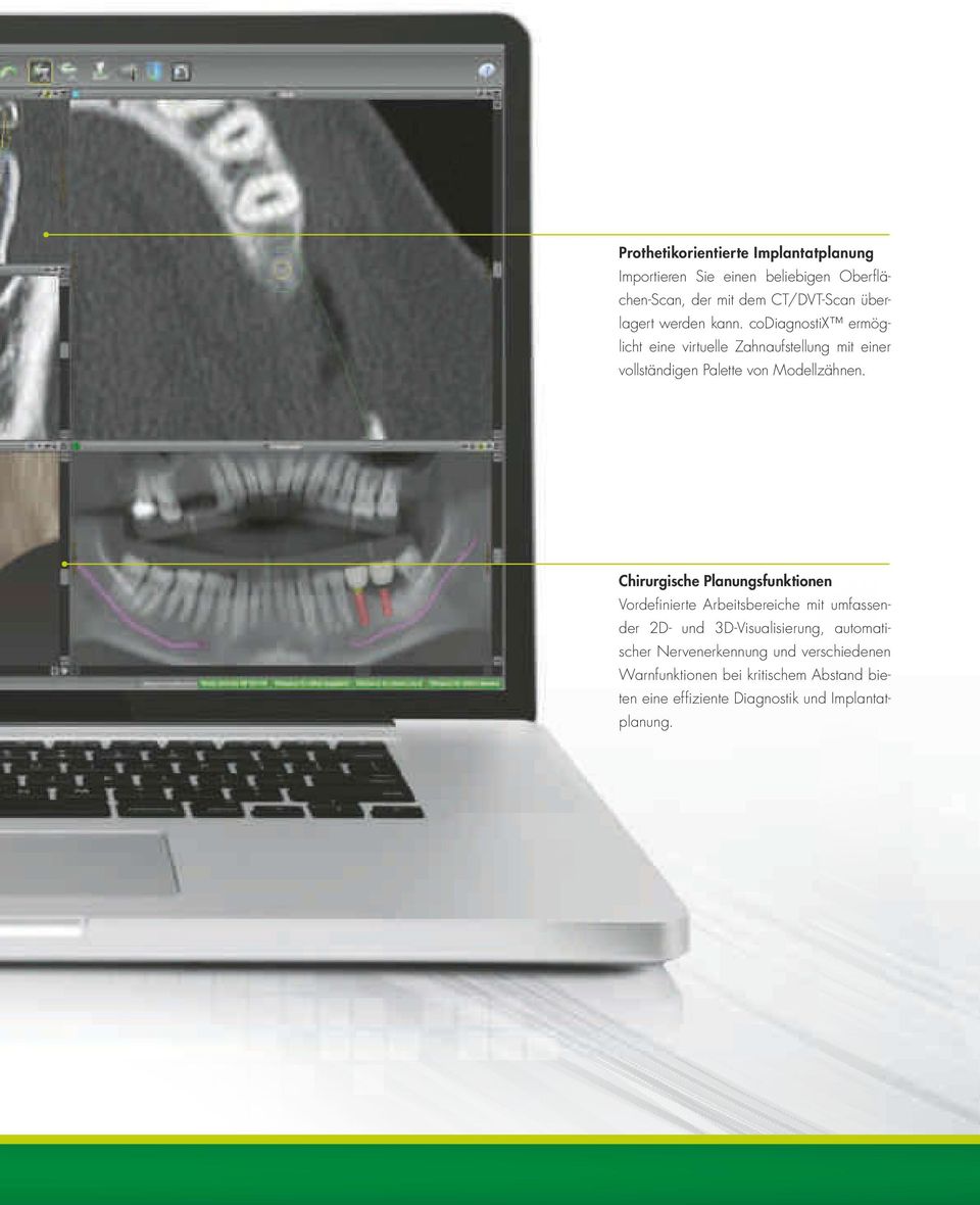 codiagnostix ermöglicht eine virtuelle Zahnaufstellung mit einer vollständigen Palette von modellzähnen.