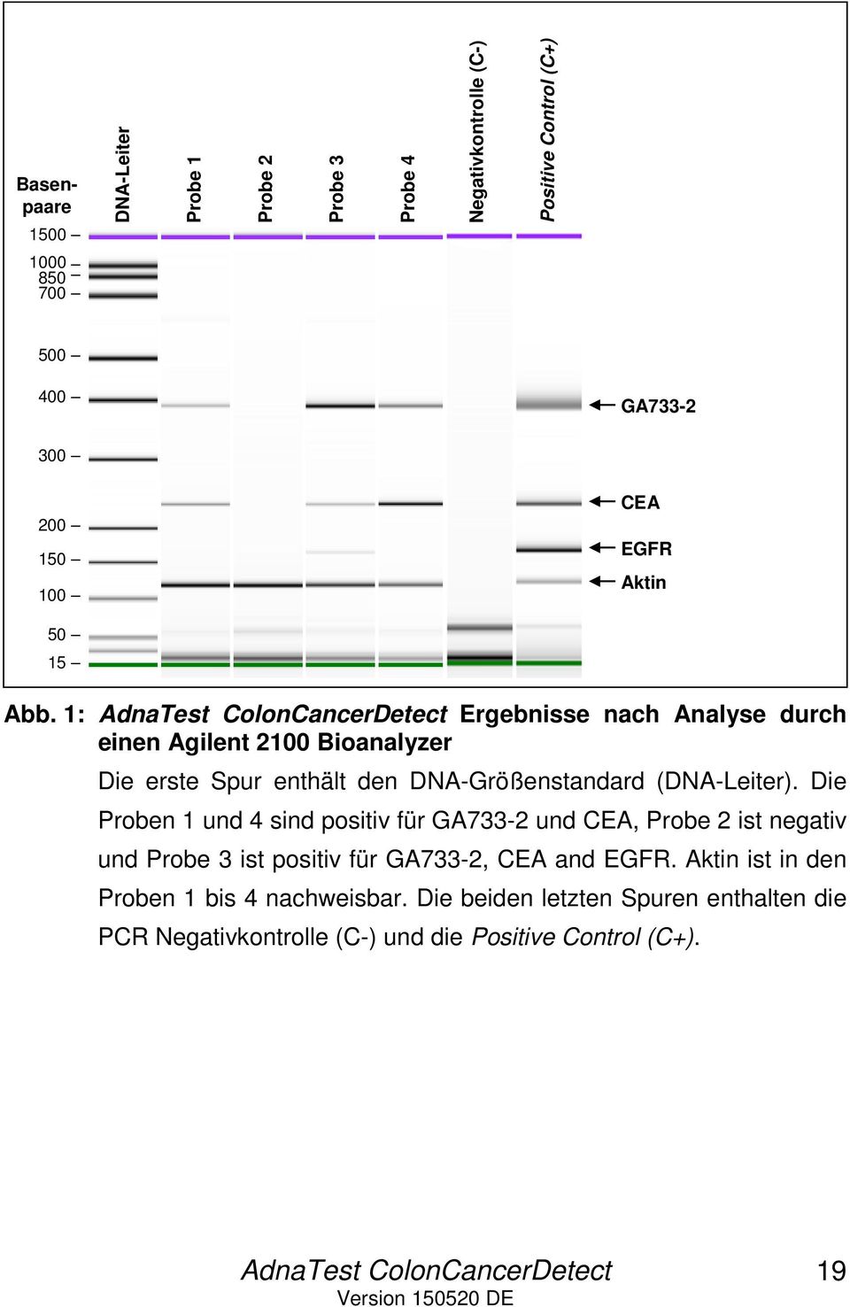 1: Ergebnisse nach Analyse durch einen Agilent 2100 Bioanalyzer Die erste Spur enthält den DNA-Größenstandard (DNA-Leiter).