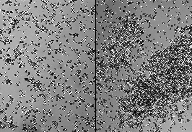 4. E R G E B N I S S E 40 VBH9810 nicht auftrat. Diese Flocken konnten auch unter dem Mikroskop dargestellt werden (Abbildung 8).