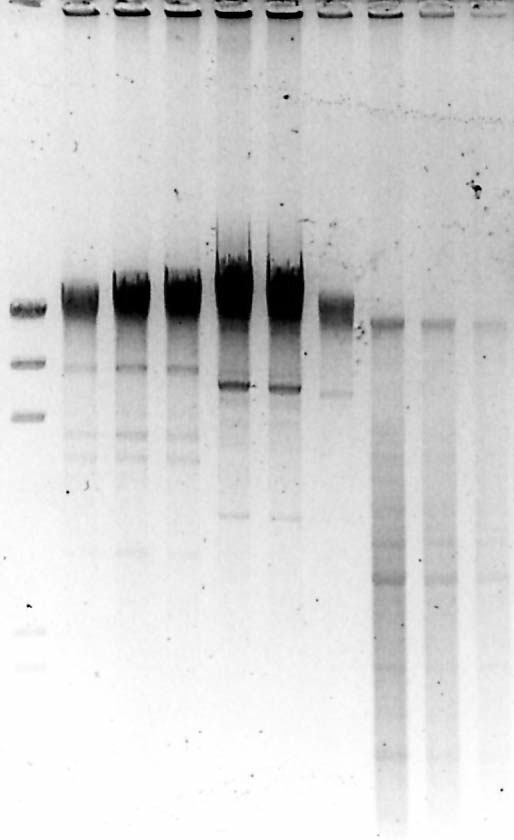 4. E R G E B N I S S E 62 BspCI trennte vier Banden mit Größen zwischen ca. 3 kb und 9,4 kb aus der DNA, wobei nur ein geringer Hintergrund entstand.