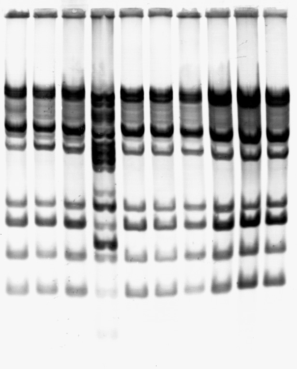 4. E R G E B N I S S E 71 1 2 3 4 5 6 7 8 9 10 Abbildung 34: Hybridisierung EcoRI-verdauter DNA mit der Ty1-15-Sonde. Neben dem Bild der Membran ist ein Schema der Bandenmuster abgebildet.