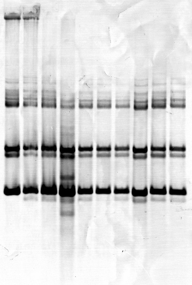 4. E R G E B N I S S E 72 1 2 3 4 5 6 7 8 9 10 Abbildung 35: Hybridisierung CfoI-verdauter DNA mit der Ty1-15-Sonde. Neben dem Bild der Membran ist ein Schema der Bandenmuster abgebildet.