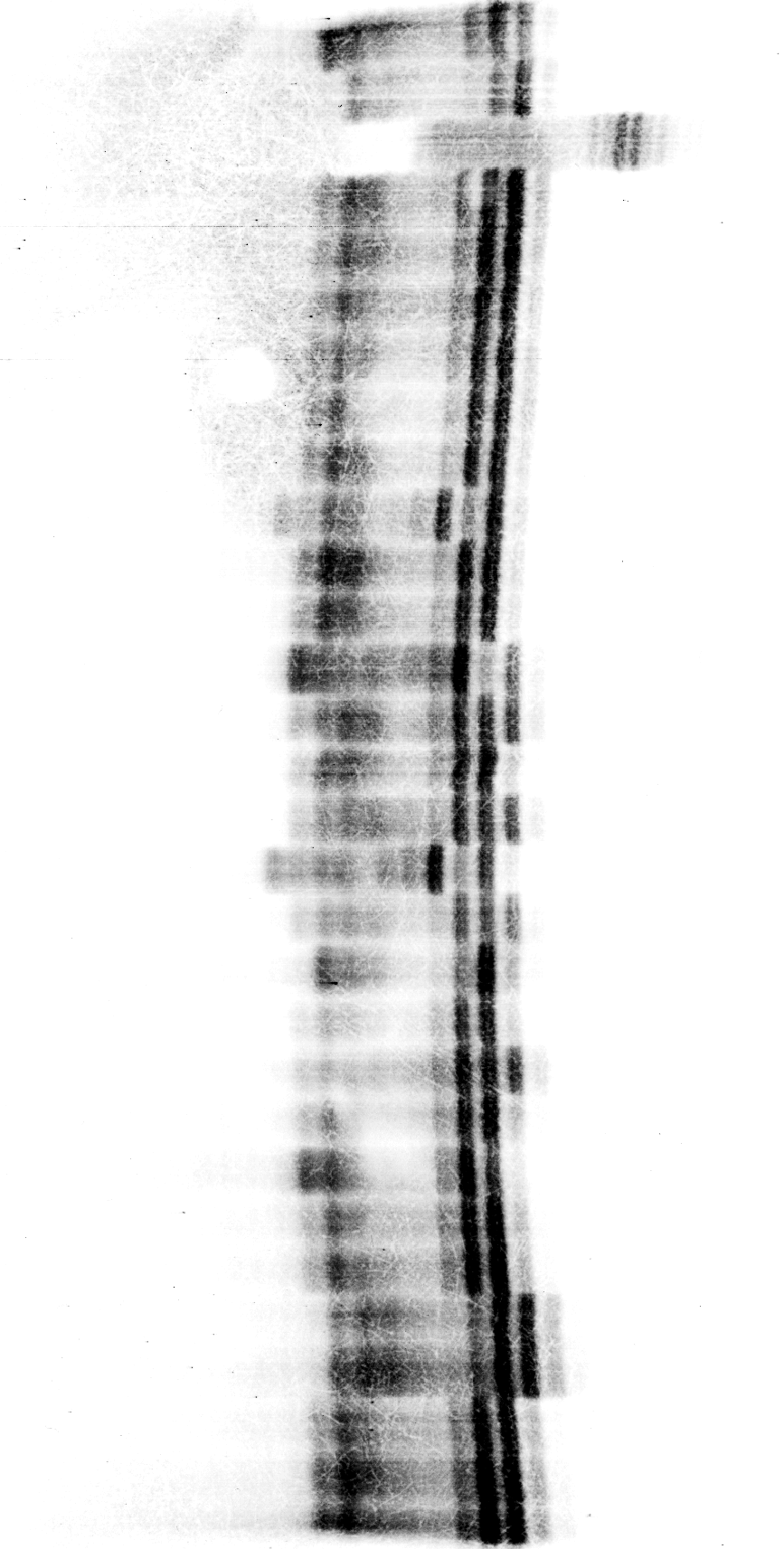 4. E R G E B N I S S E 77 Chromosom IV, Motiv TA/TG Das zweite der auf Chromosom IV untersuchten Motive ergab ein verhältnismäßig kompaktes Muster aus etwa sechs Banden im Größenbereich von etwa 180
