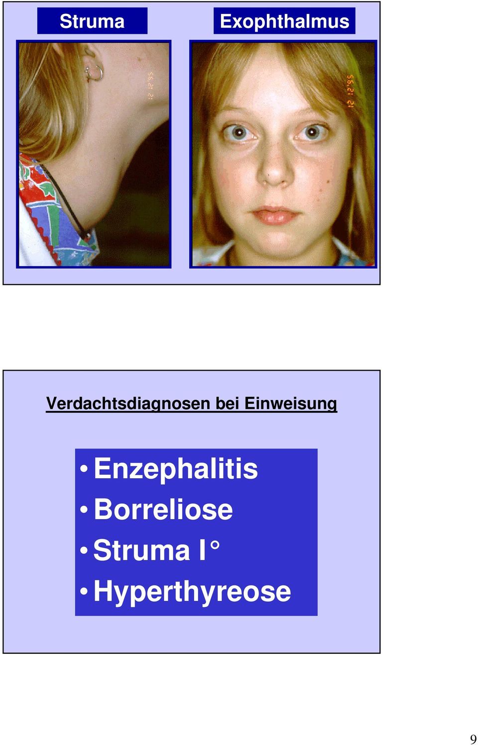Einweisung Enzephalitis